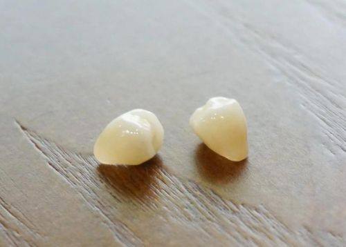 广州海韵口腔门诊部真人口碑评价怎么样？