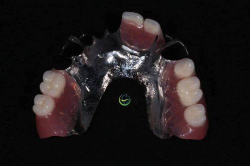 桓台美澳口腔特色项目及技术优势