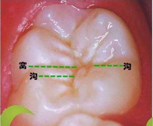 广州海韵口腔门诊部是正规医院吗？