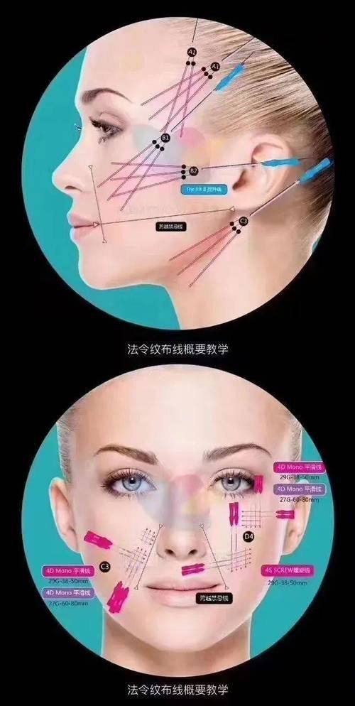 广州华一（原唯臻）医疗美容门诊部是正规医院吗？