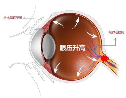 深圳市蛇口人民医院眼科真人口碑评价怎么样？