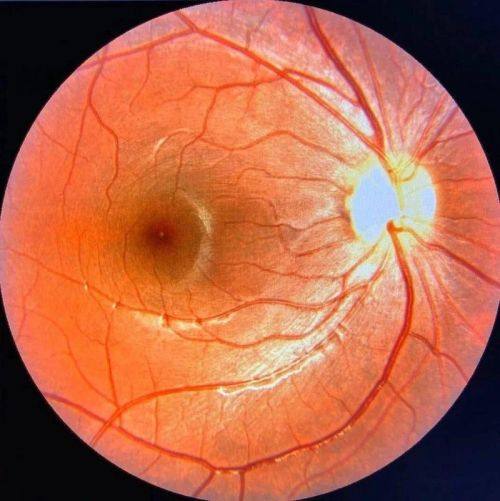 深圳市蛇口人民医院眼科收费价格表/收费标准