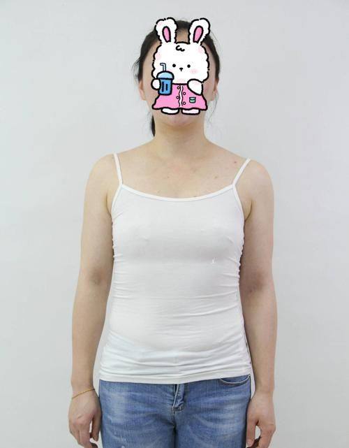 广州姬妍医学美容整形医院收费价格表/收费标准