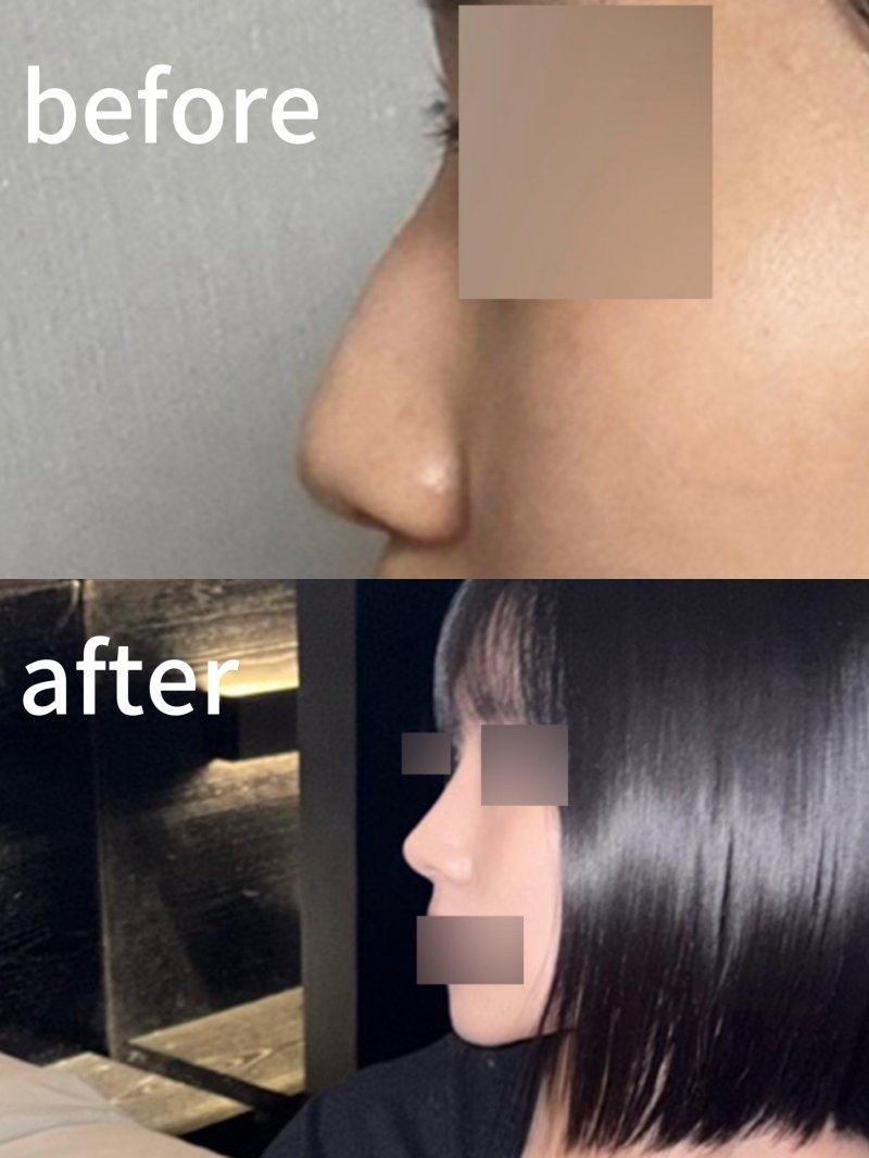 宝鸡李家本草皮肤病医院详细的预约挂号方式及流程