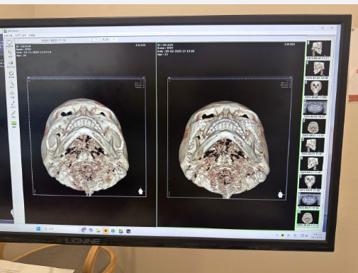 宝鸡李家本草皮肤病医院收费价格表/收费标准