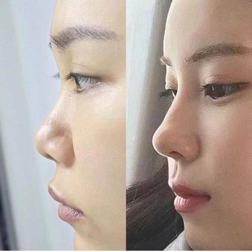 北京美之星医疗美容医院详细的预约挂号方式及流程