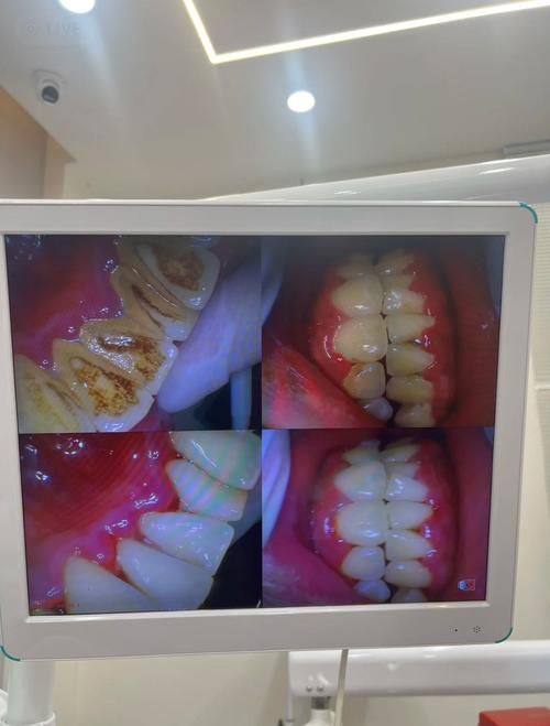 通化市中 心医院口腔科真人口碑评价怎么样？