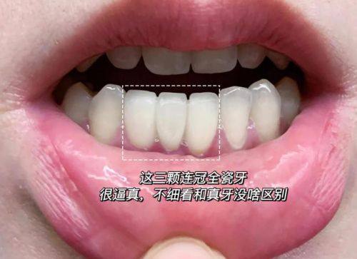 通化市中 心医院口腔科医生团队实力强大及骨干医生简介