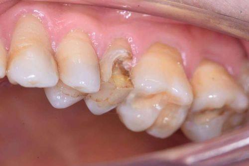 上海辉歌口腔门诊部（静安区）收费价格表/收费标准