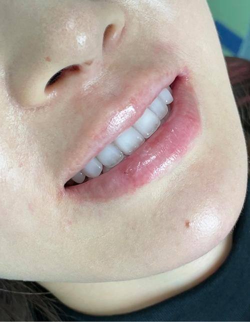 深圳同步同欣口腔门诊部特色项目及技术优势