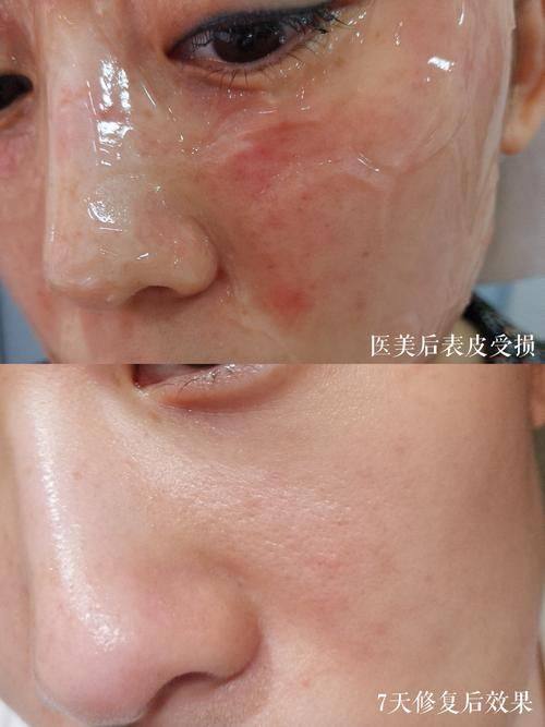 重庆亚美医疗美容门诊部真人口碑评价怎么样？