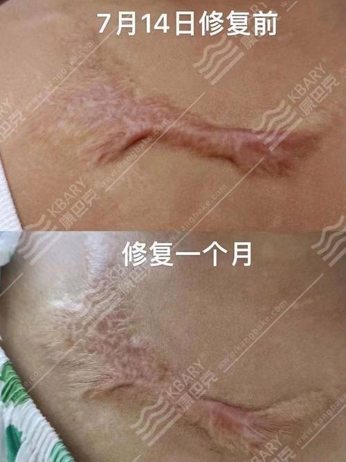 北京美之星医疗美容医院真人口碑评价怎么样？