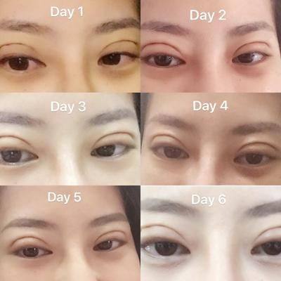 重庆康桥整形美容是正规医院吗？