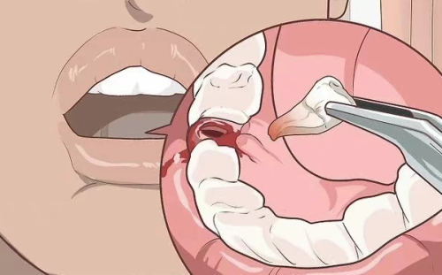 广州优德口腔（员岗店）真人口碑评价怎么样？