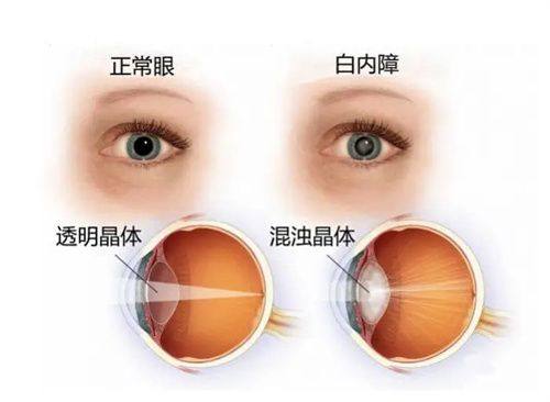 平煤神马医疗集团总医院眼科地址电话营业时间