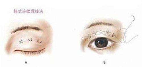 武汉瑞兮恩医疗美容门诊部是正规医院吗？