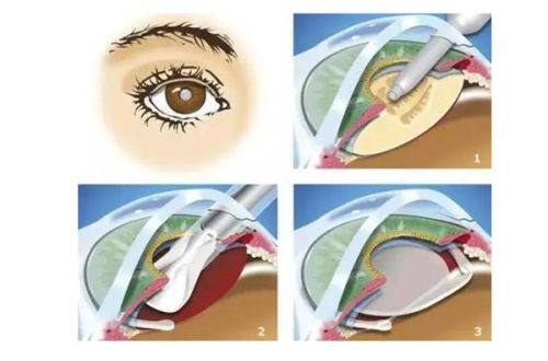 徐州瑞安医院眼科医生团队实力强大及骨干医生简介