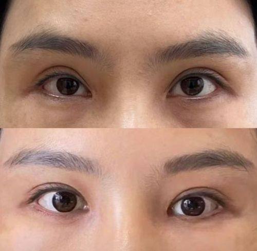 北京中关村医院激光整形美容中 心真人口碑评价怎么样？