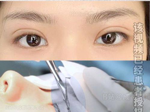 信阳东美整形美容医院真人口碑评价怎么样？