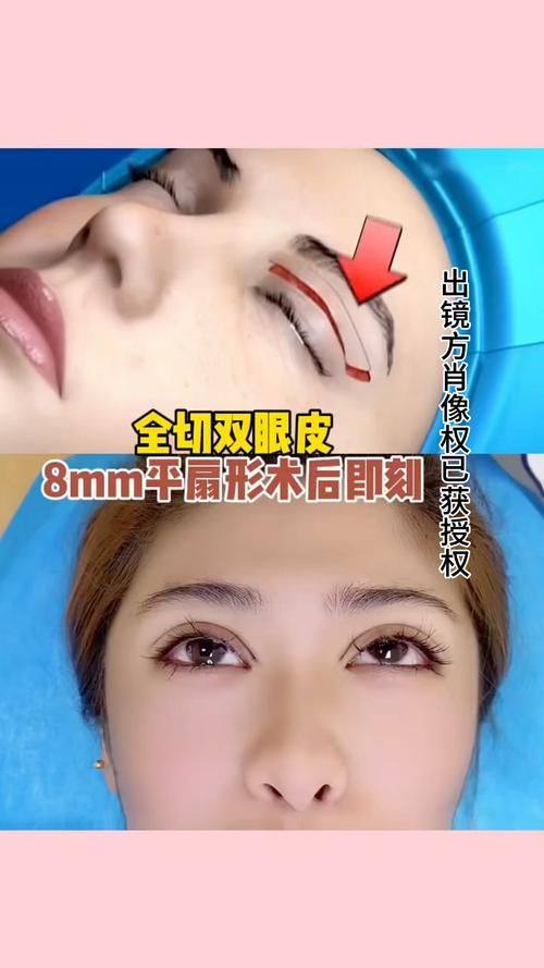 信阳东美整形美容医院详细的预约挂号方式及流程