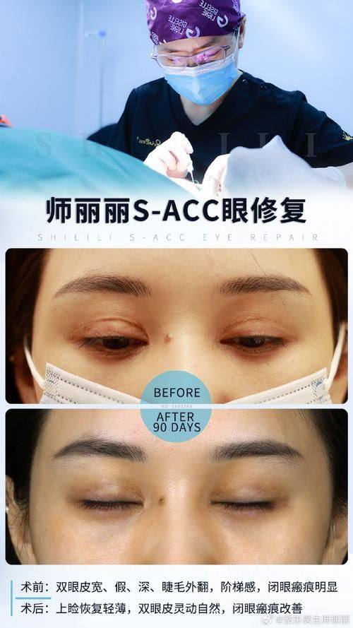 信阳东美整形美容医院收费价格表/收费标准