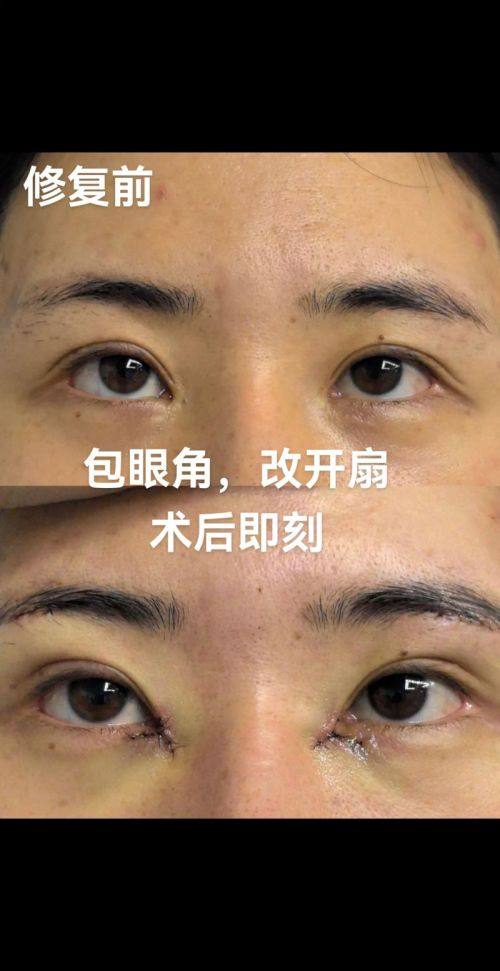 武汉瑞兮恩医疗美容门诊部特色项目及技术优势