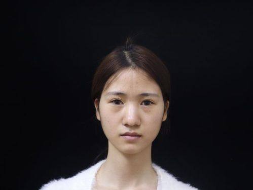 泰兴柏丽整形外科门诊部特色项目及技术优势