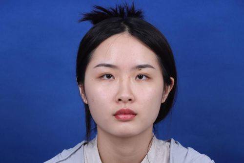 成都高新米兰柏羽医学美容医院收费价格表/收费标准