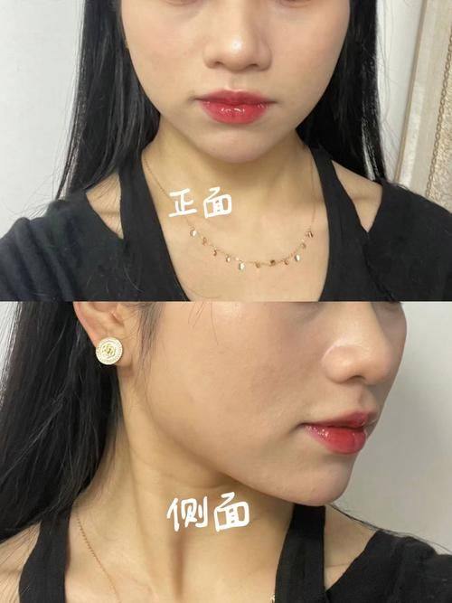 泰兴柏丽整形外科门诊部地址电话营业时间