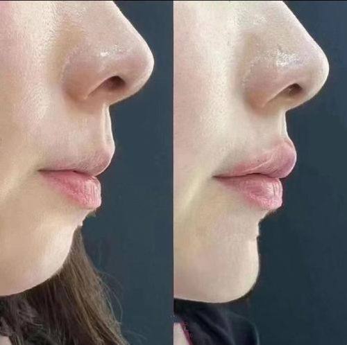 泰兴柏丽整形外科门诊部收费价格表/收费标准