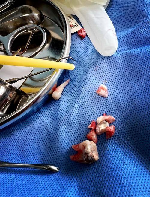 广州优德口腔（员岗店）特色项目及技术优势