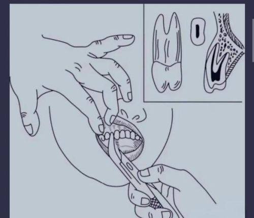 肇庆四会瑞尔口腔是正规医院吗？