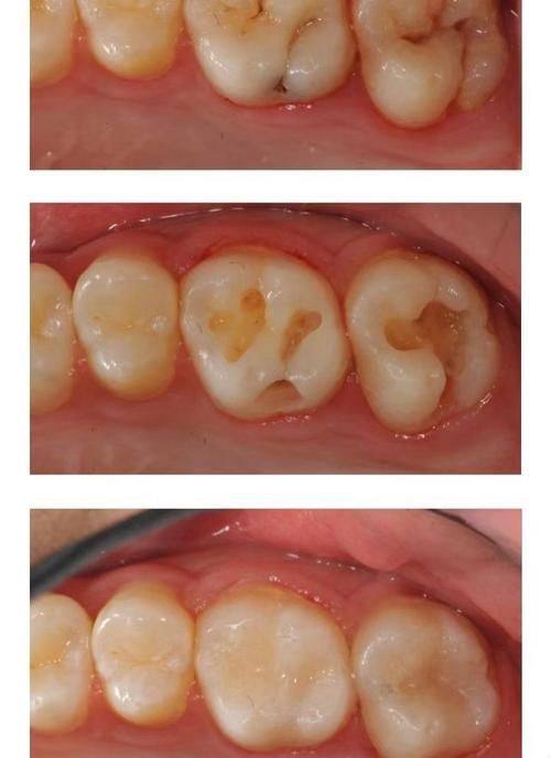 常德美丽坚口腔诊所真人口碑评价怎么样？