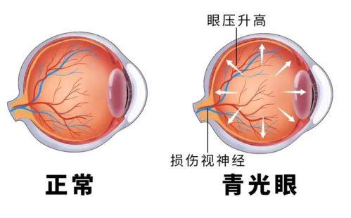 平煤神马医疗集团总医院眼科收费价格表/收费标准