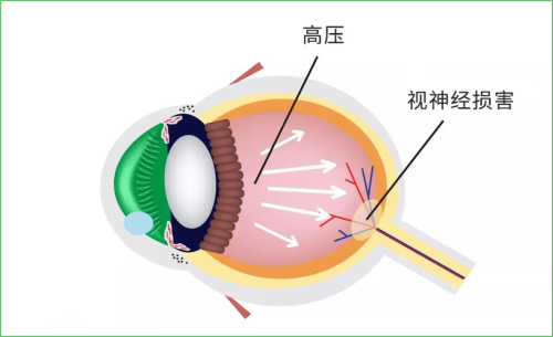 徐州瑞安医院眼科地址电话营业时间