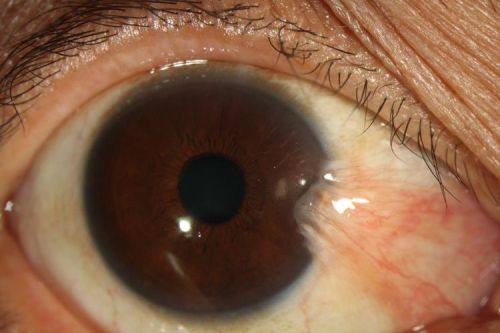 徐州瑞安医院眼科特色项目及技术优势