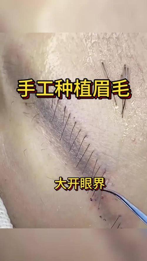 昆明新生植发医生团队实力强大及骨干医生简介