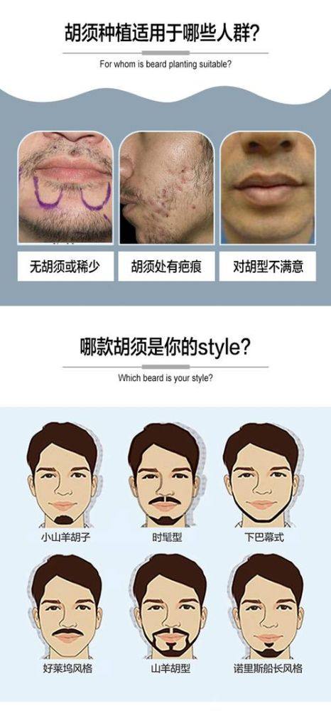 昆明新生植发是正规医院吗？