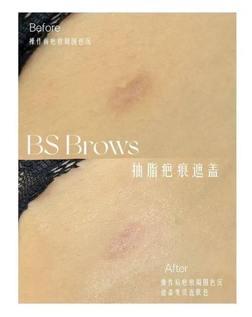 菏泽悦美整形美容医院特色项目及技术优势