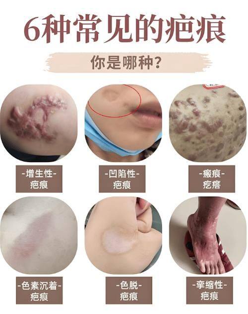 泰兴柏丽整形外科门诊部详细的预约挂号方式及流程