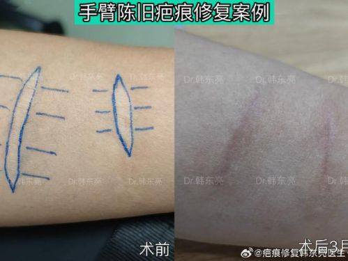 菏泽悦美整形美容医院地址电话营业时间