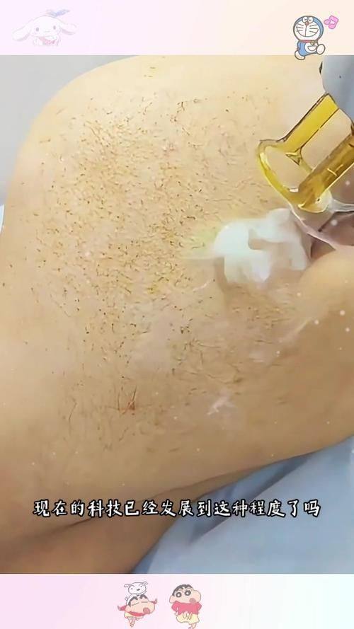 北京中关村医院激光整形美容中 心收费价格表/收费标准