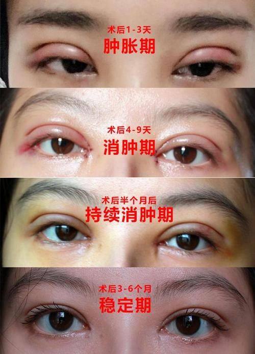 菏泽悦美整形美容医院详细的预约挂号方式及流程