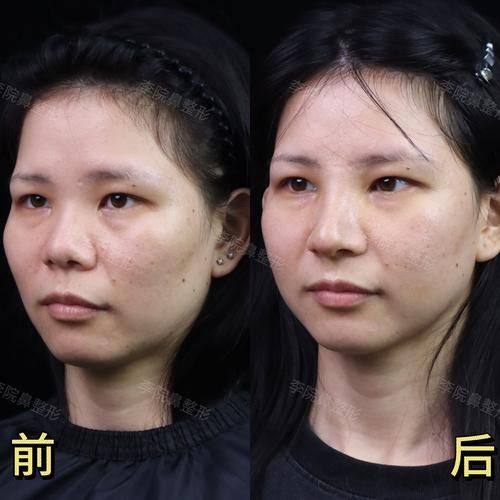 北京中关村医院激光整形美容中 心详细的预约挂号方式及流程