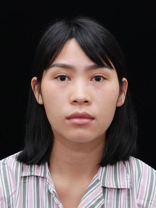 信阳东美整形美容医院地址电话营业时间