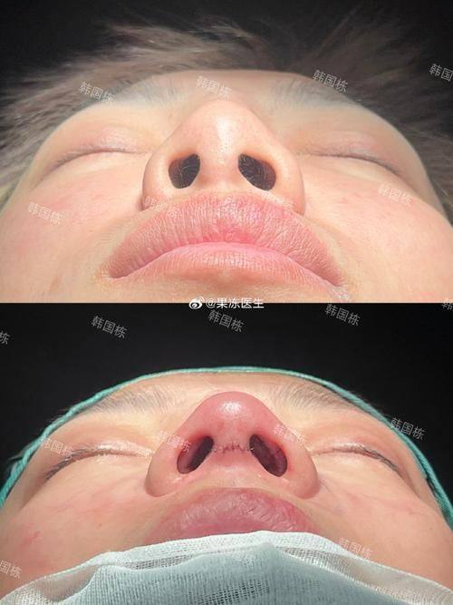 北京中关村医院激光整形美容中 心特色项目及技术优势