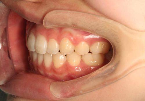 常德美丽坚口腔诊所详细的预约挂号方式及流程