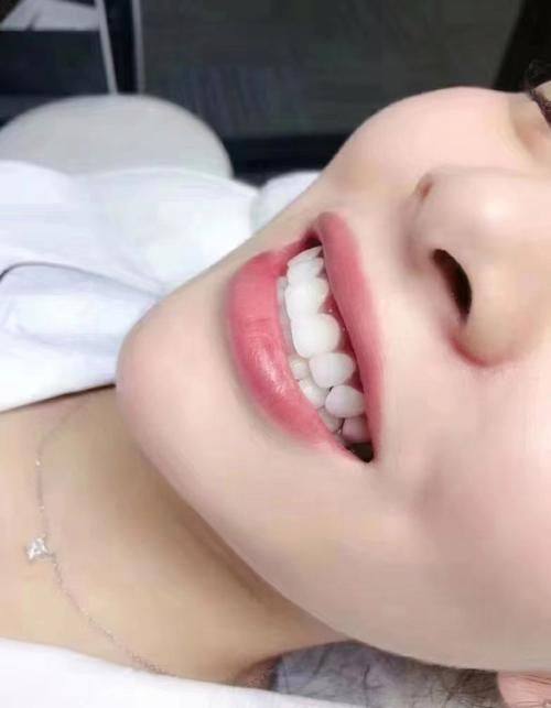 江西九江曾文娟口腔真人口碑评价怎么样？