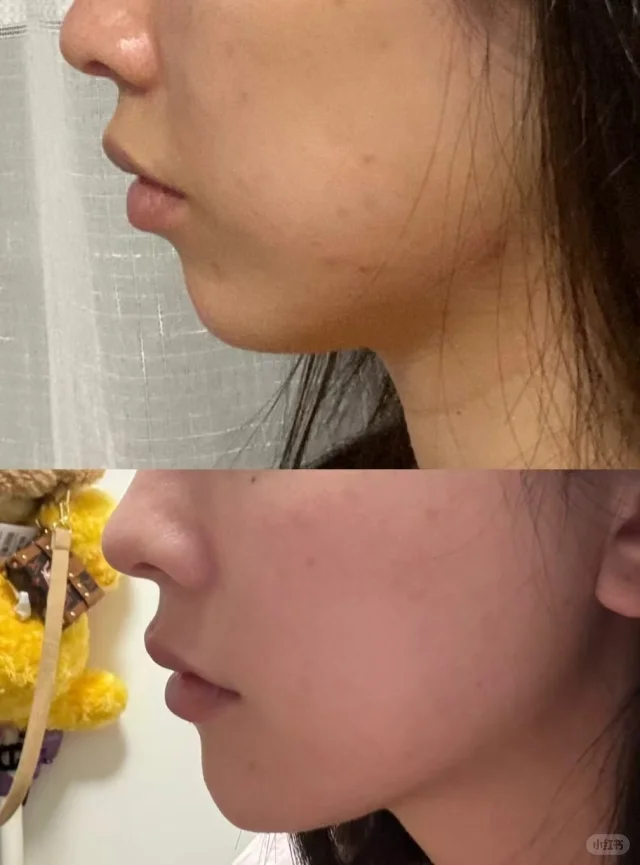 成都高新米兰柏羽医学美容医院是正规医院吗？