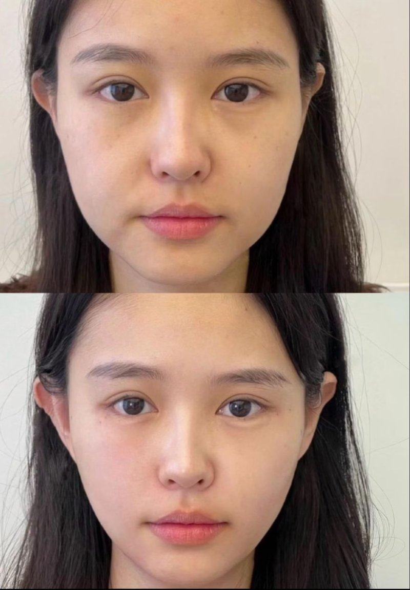 成都高新米兰柏羽医学美容医院详细的预约挂号方式及流程